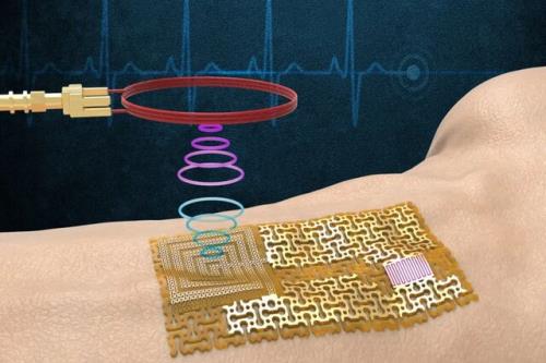 ابداع یک پوست الکترونیکی بدون تراشه و بی سیم برای نظارت بر سلامتی