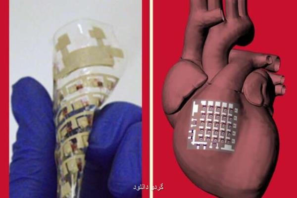 بررسی مشكلات قلبی با كمك برچسبی كه روی قلب قرار می گیرد